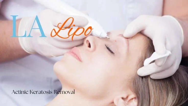 Woman receiving Actinic Keratosis Removal Treatment The Potteries