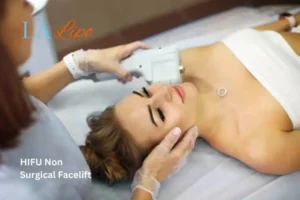Woman having Hi-Fu to reduce wrinkles The Potteries.
