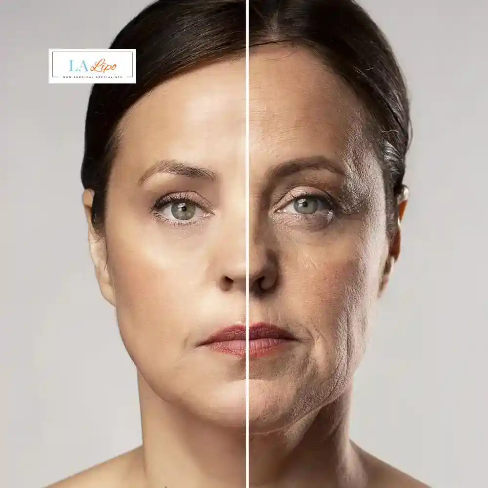How Can You Tell If Non-Surgical Skin Tightening Is Right for You The Potteries?