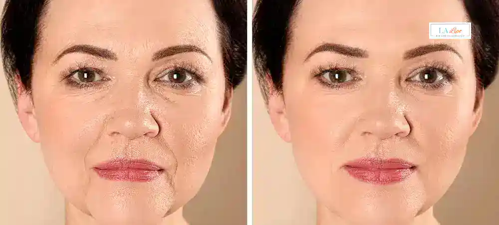 Why Aren’t My Skincare Products Making My Sagging Skin Look Firmer The Potteries?