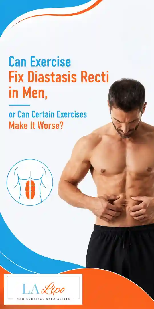 Can Exercise Fix Diastasis Recti in Men, or Can Certain Exercises Make It Worse The Potteries?